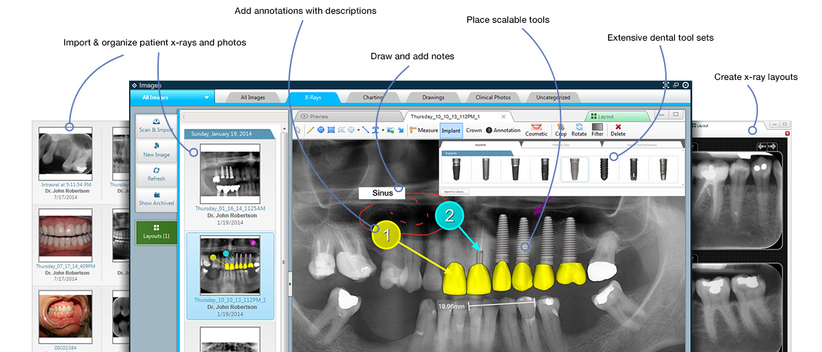 Dental Imaging Software
