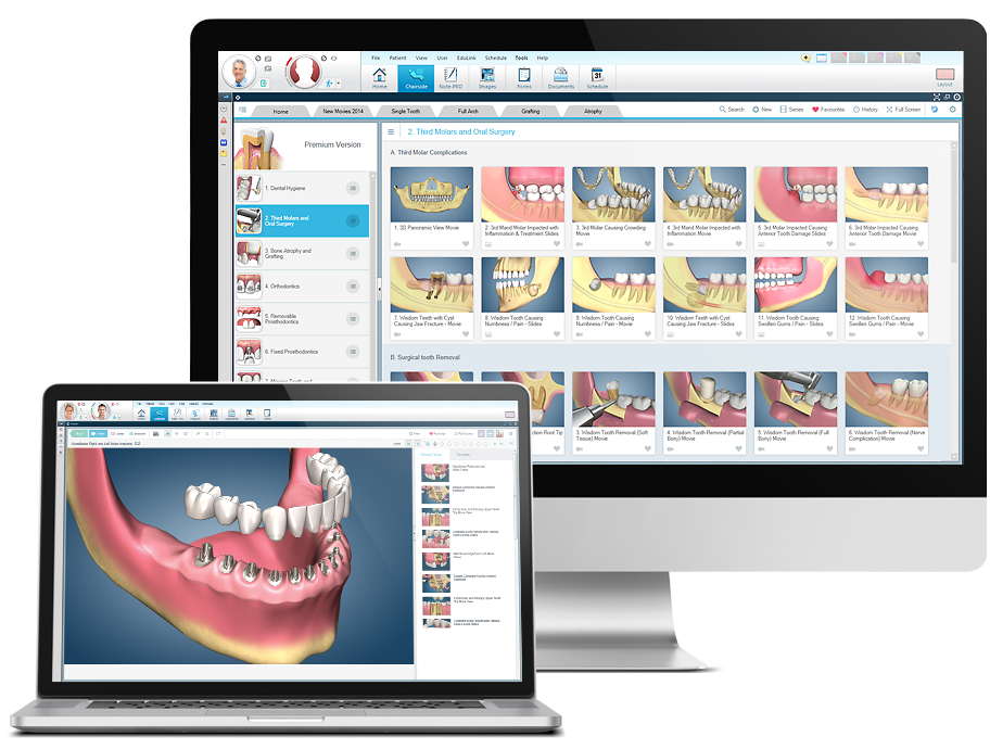 Consult-PRO Teledentistry Software