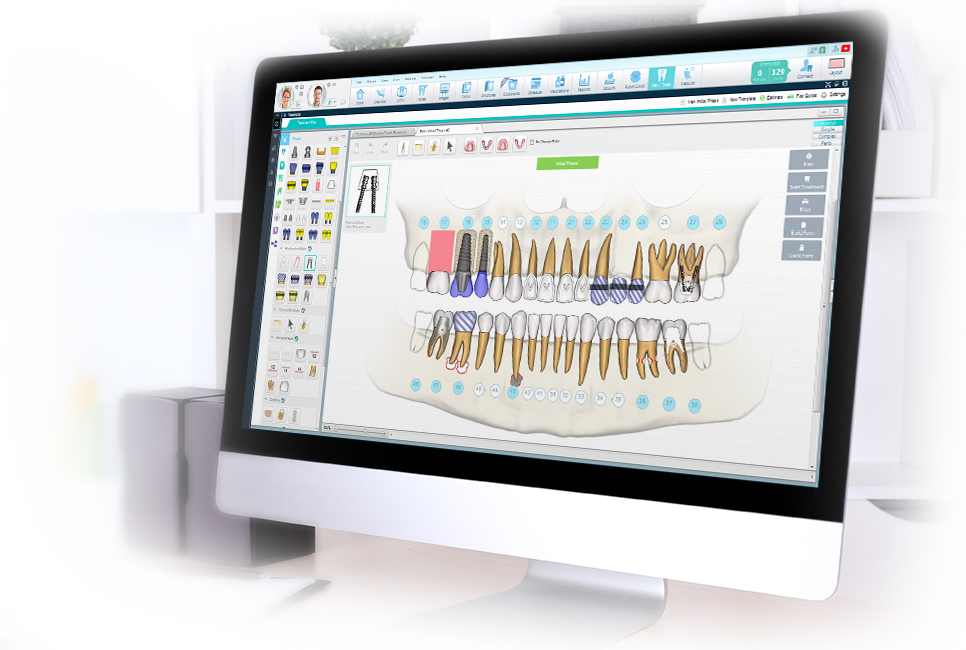 Consult-PRO Dental Software